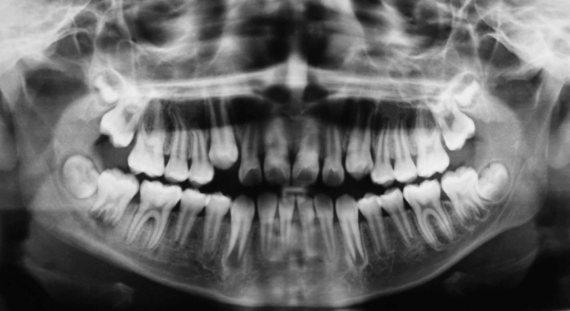 radiologia en Linares, Clínica Dental de Torres y Polaina
