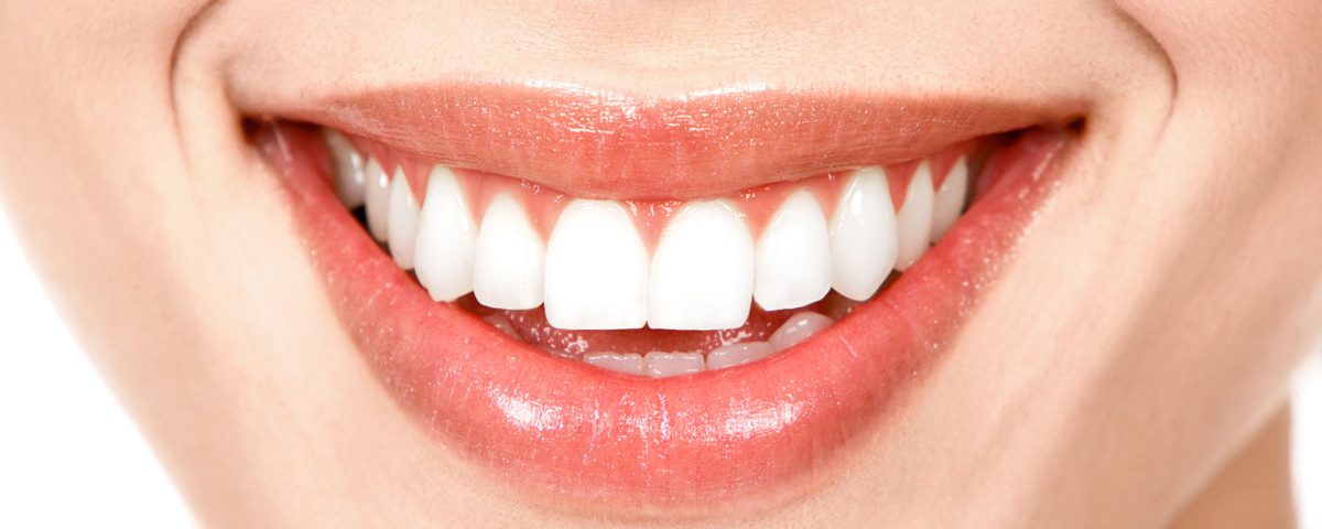 Blanqueamiento dental Clínica Dental de Torres y Polaina en Linares,
