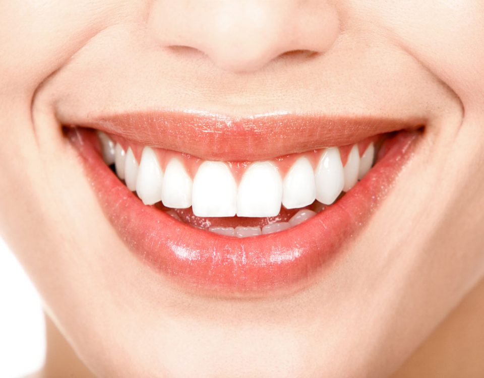 Blanqueamiento dental Clínica Dental de Torres y Polaina en Linares,