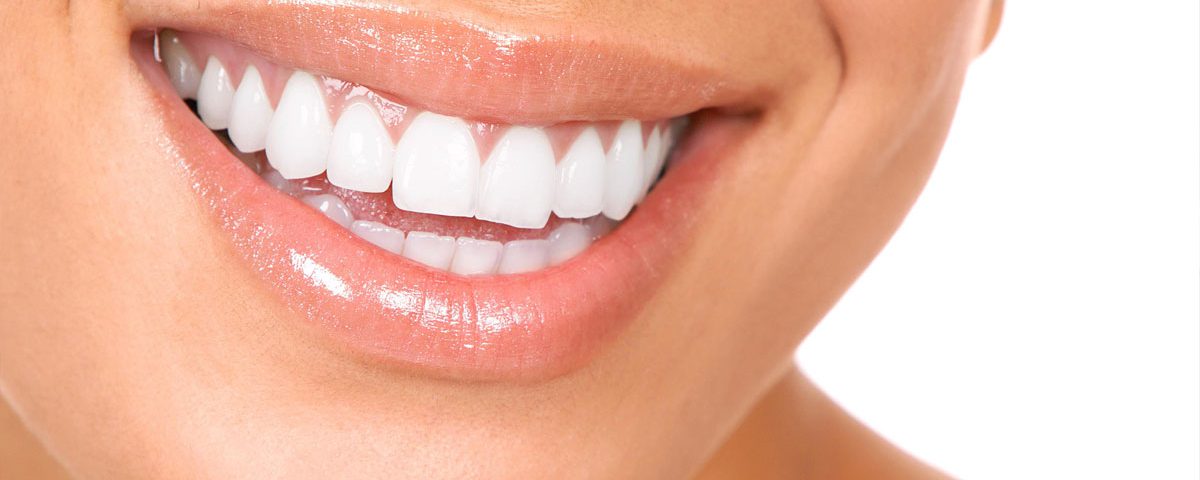 Estética Dental en Clínica de Torres y Polaina