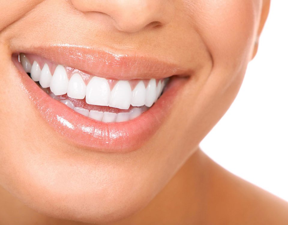 Estética Dental en Clínica de Torres y Polaina