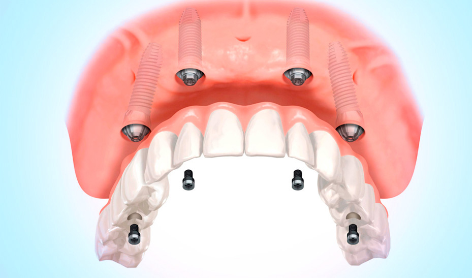 dentista linares
